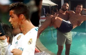 cristiano ronaldo accidentare